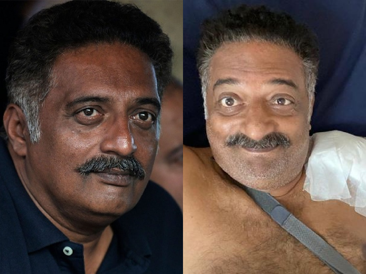 Accident के बाद Prakash Raj ने कराई Surgery, तस्वीर शेयर कर बोले- devil is back…