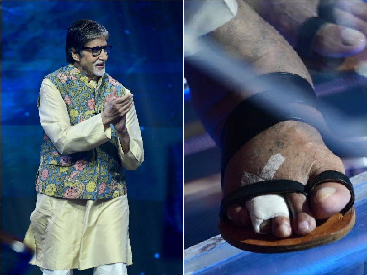 Accident: Amitabh Bachchan के साथ हुआ दर्दनाक हादसा, पैर में हुआ फ्रैक्चर जाहीर किया दर्द