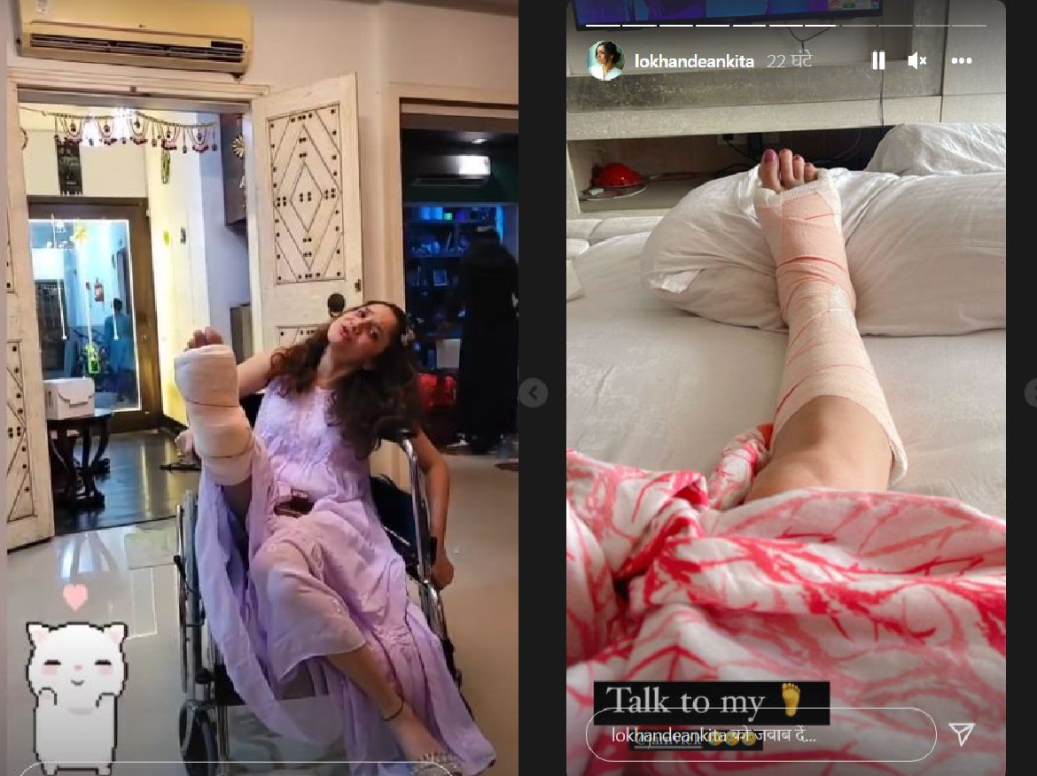 शादी से ठीक पहले एक्ट्रेस हुई घायल पैर में बंधी पट्टी, Vicky तस्वीर शेयर कर बोले- बस यूं …