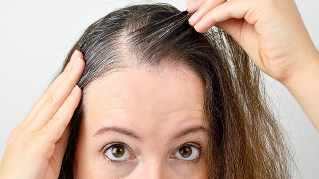 जानिए बालों को समय से पहले सफेद होने से बचाने के आयुर्वेदिक उपचार