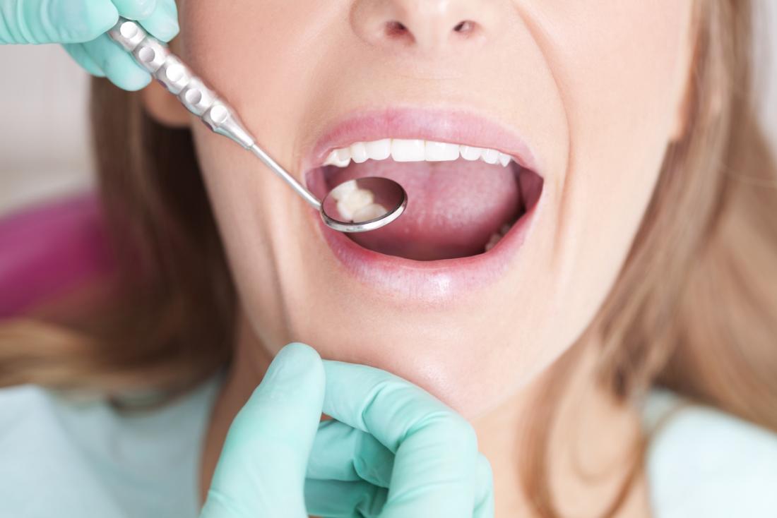 जानिए कैसे आप अपने दांतों को स्वस्थ रख सकते हैं और उन्हें कैविटी से बचा सकते हैं
