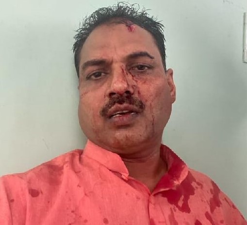 Lucknow News : यूपी की राजधानी लखनऊ में बीजेपी पार्षद पर जानलेवा हमला, पुलिस जांच में जुटी