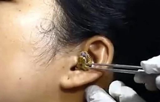 Viral Video: देखिए किस तरह महिला के कान में घुस गया सांप, वीडियो देखकर चौक जाएंगे