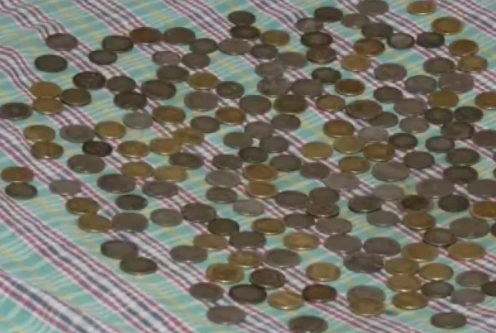 Coins In Man Stomach: डॉक्टरों ने शख्स के पेट से निकाले 1.2 KG सिक्के, जाने क्या है पूरा मामला