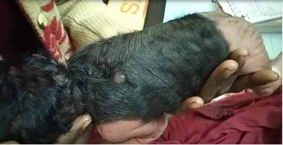 Miracle News : हरदोई में महिला ने एक विचित्र बच्चे को दिया जन्म, सिर से लेकर कमर तक बाल ही बाल…