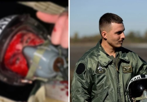 खून से लथपथ लड़ाकू विमान के पायलट ने ली सेल्फी, फोटो वायरल
