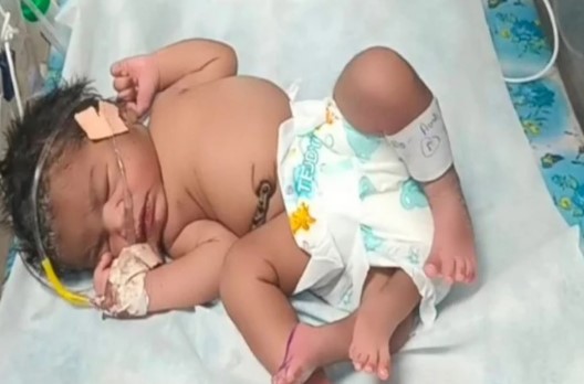 Shocking! महिला ने ‘चार’ पैरों वाली बच्ची को दिया जन्म, पढ़े पूरी खबर