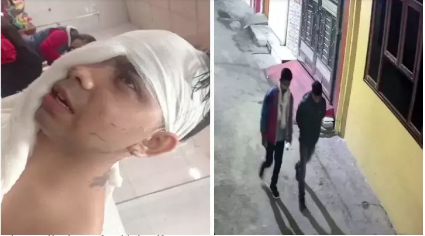 Acid attack in Lucknow : गोमतीनगर विराम खंड में दबंगों ने घर में घुसकर मां-बेटे पर किया एसिड अटैक , दोनों झुलसे अस्पताल में भर्ती