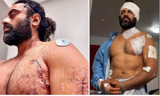Attack on Aman Dhaliwal: भारतीय एक्टर पर विदेश में कुल्हाड़ी और चाकू से हुआ हमला, गंभीर रूप से हुए घायल
